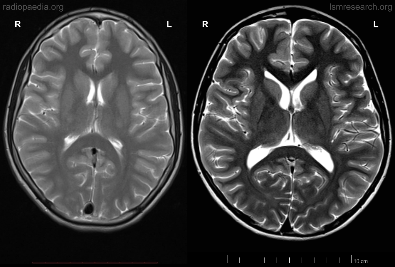 Neurology of our lack of the social mindset | LSM Research – Neurology ...
